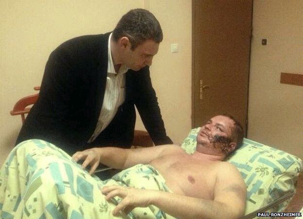 Opposition politician Vitali Klitschko visited Dmytro Bulatov in hospital (photo: Paul Ronzheimer, Bild Zeitung)