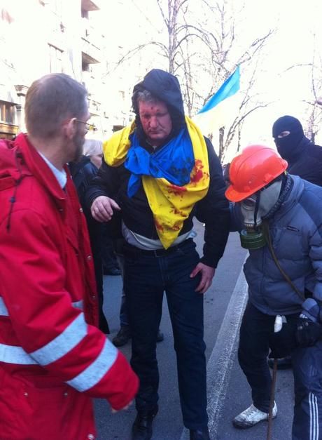 One of dozens injured in clashes today between police and protesters.