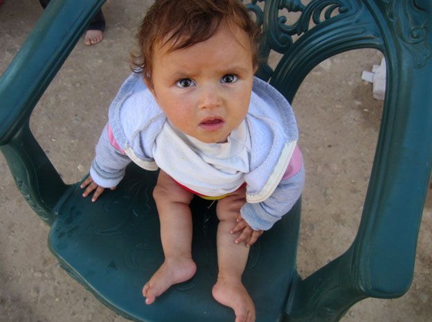A child in eastern Syria with legs paralysed because of polio