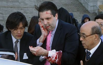 Ambassador to South Korea was injured by a man wielding a razor in Seoul, and his assailant was immediately detained.
