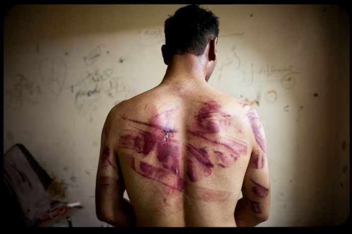 'Clear evidence' of systematic torture in Syria