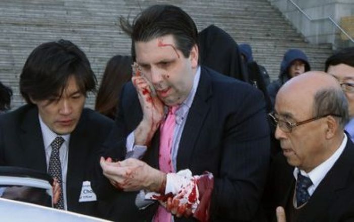 US ambassador to South Korea injured in razor attack