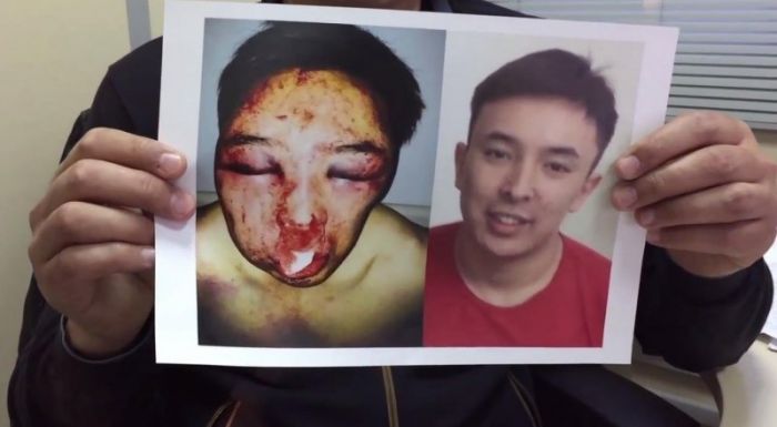 Brutal Assault Galvanizes Kazakh Public