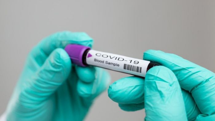 Three cases of coronavirus infection in Atyrau region