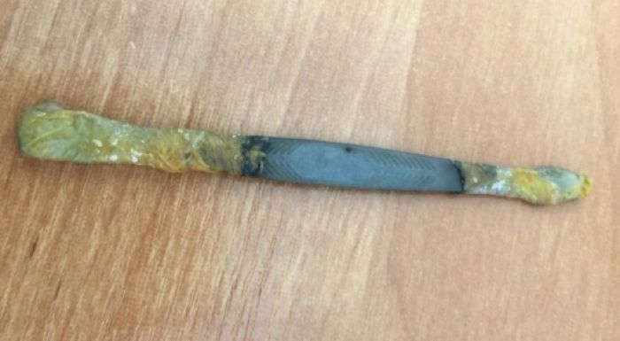 Маңғыстау дәрігерлері сотталған адамның асқазанынан скальпель тапты