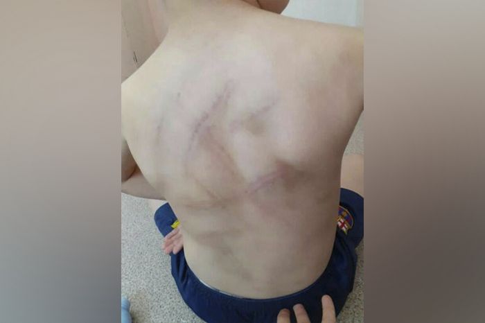 Баласын арматурамен ұру оқиғасы: Істі полиция бақылауына алды