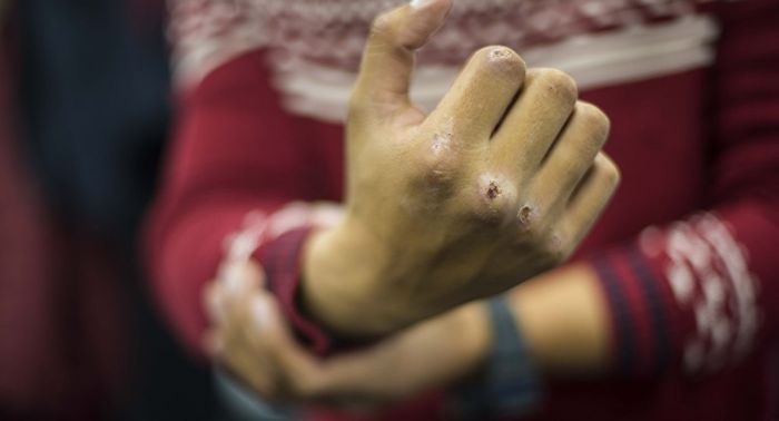 Ақтөбе облысында жасөспірімдер адам өлтірген  