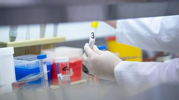 Атырау облысында коронавирусты анықтайтын 700-ге жуық сынама тест бар