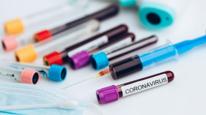 Атырау облысында коронавирус жұқтырған тағы 3 адам анықталды