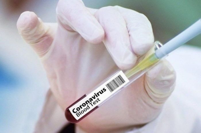 Атырау облысында коронавирус жұқтырған 3 адам анықталды