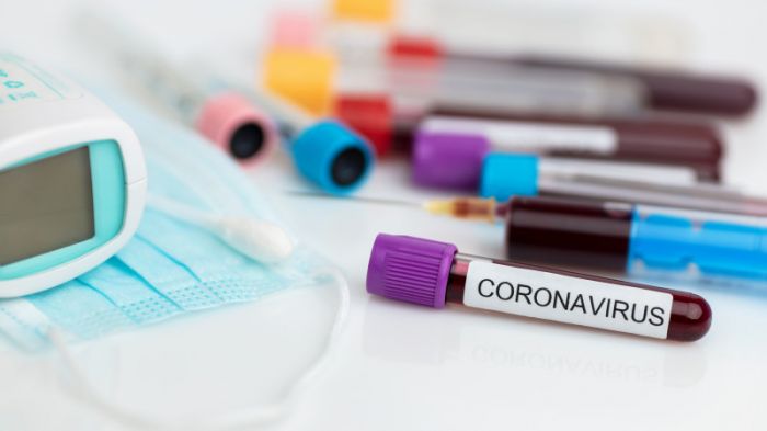Атырау облысынан коронавирус жұқтырған 142 науқас анықталды