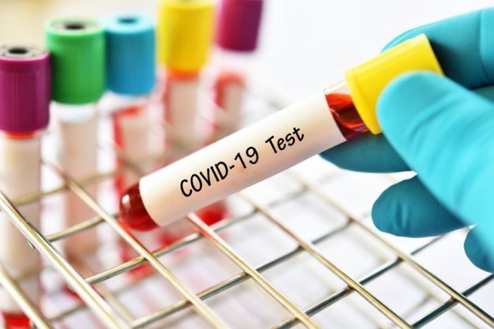 Бүгін тағы 474 қазақстандықтан коронавирус анықталды