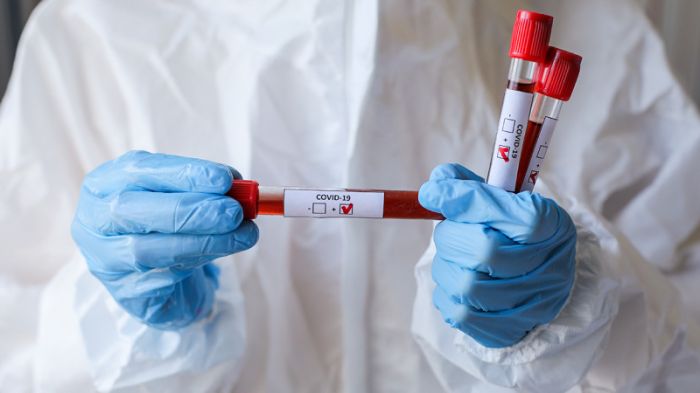 Елімізде бір тәулікте мыңнан аса адамнан коронавирус анықталды