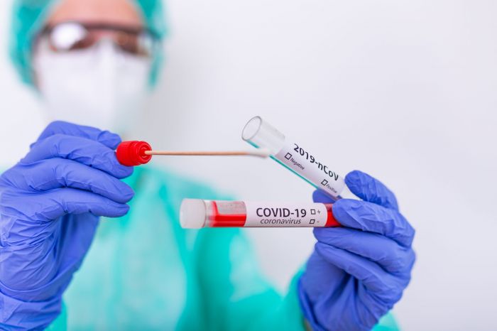 Өткен тәулікте коронавирус инфекциясын жұқтырудың 762 жағдайы тіркелді
