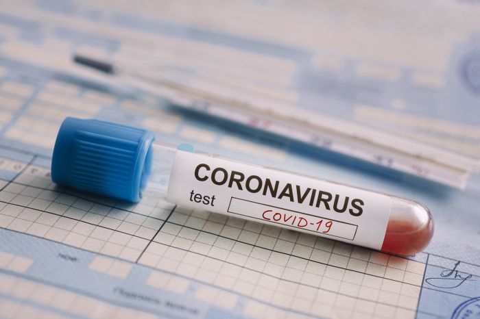 Елімізде бір тәулікте 800-ге жуық адамнан коронавирус анықталды