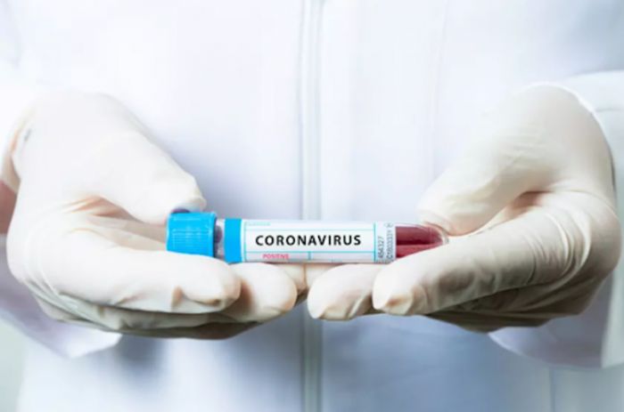​Қазақстанда өткен тәулікте 2719 адамнан коронавирус анықталды