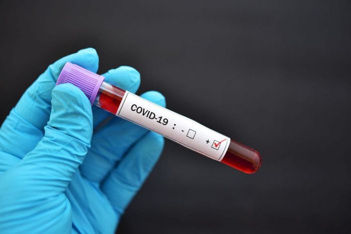 Қазақстанда соңғы тәулік ішінде 757 адамнан ​коронавирус анықталды