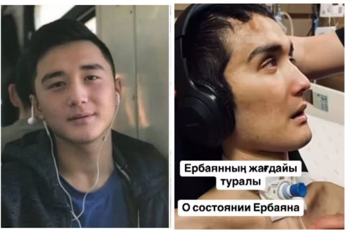 Сарбаз Ербаян Мұхтардың денсаулығы жақсарды 