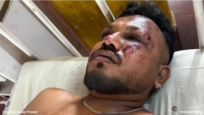 Үндістандағы әуе апатынан аман қалған жалғыз жолаушы: «Көз алдымда адамдар қаза тапты»