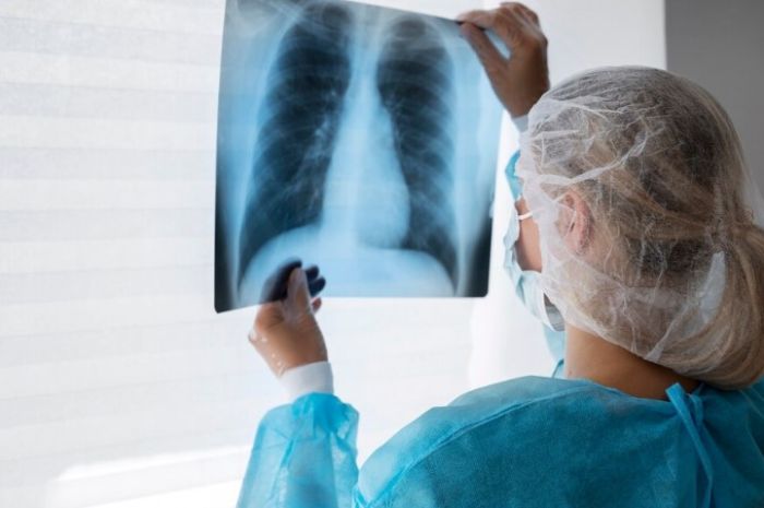 Қазақстанда 8,6 мың адам туберкулезге қарсы ем алды