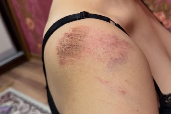 Атырауда блогерді ұрып-соғу ісіне қатысты күдіктілердің бірі ұсталды