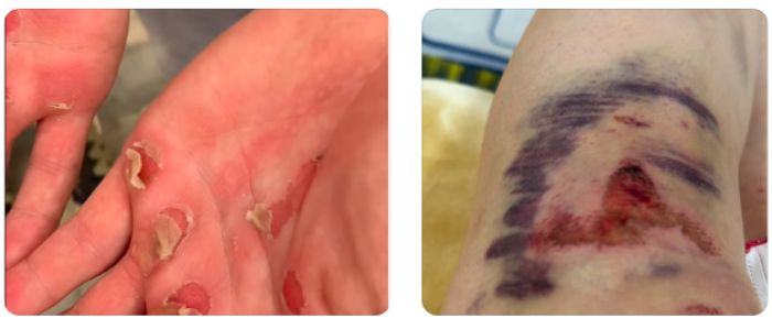 ​Дубайдағы жеңіс «Томириске» оңай келген жоқ