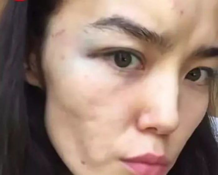  Казахстанский дипломат избивал жену: полиция возбудила уголовное дело