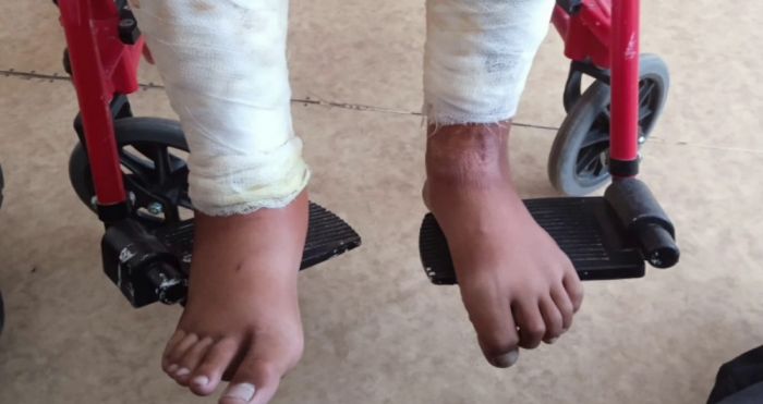 Подростка подожгли в Карагандинской области