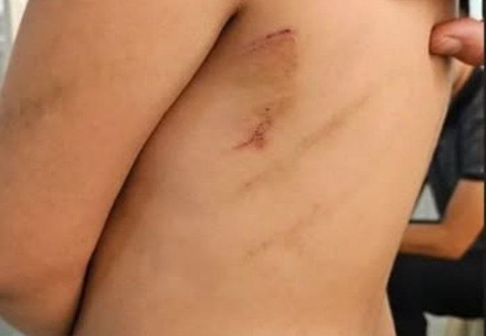 34 дня в психбольнице без оснований: жительнице Алматинской области присудили 2 млн тенге компенсации