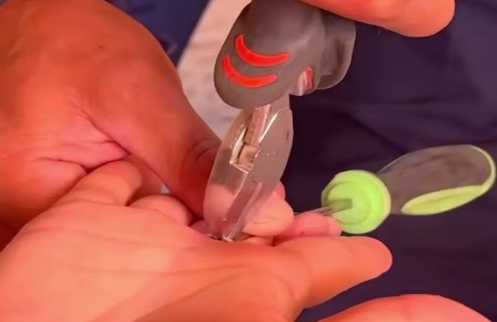 В Атырау спасатели помогли женщине снять застрявшее кольцо