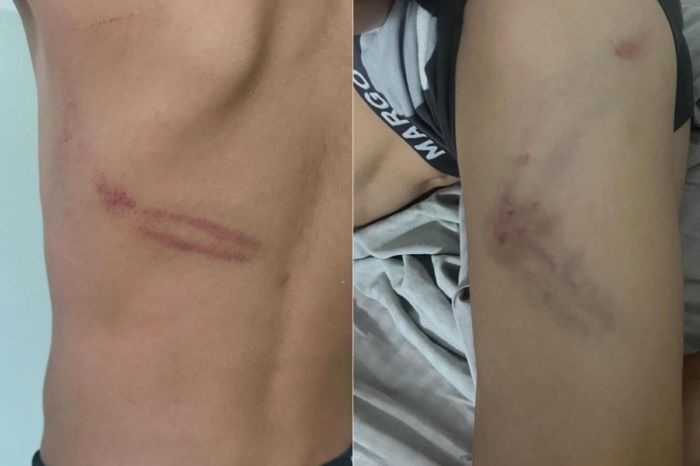 Закиева требует расследовать пытки ребёнка в Балхаше