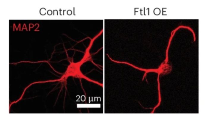 «Белок старения»: учёные открыли причину ухудшения памяти