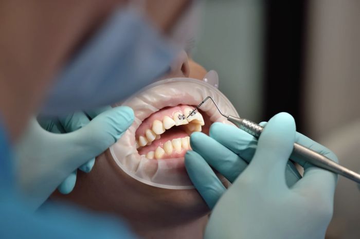 Минздрав хочет запретить казахстанцам лечить зубы за счет "пенсионки"