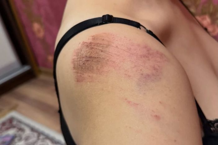 В Атырау задержана одна из подозреваемых по делу об избиении блогера