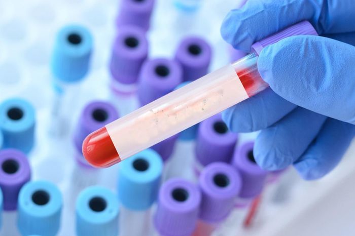 Новый вариант COVID-19 «Стратус» распространяется у соседей: что важно знать казахстанцам