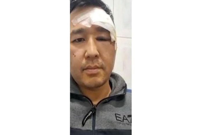 «​Разнимал драку и получил монтировкой по голове»​: адвокаты об Асете Матаеве​