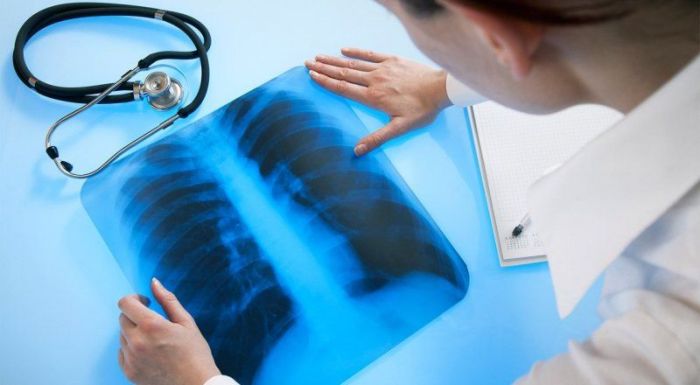 Случай туберкулеза выявили у студента колледжа в Алматы