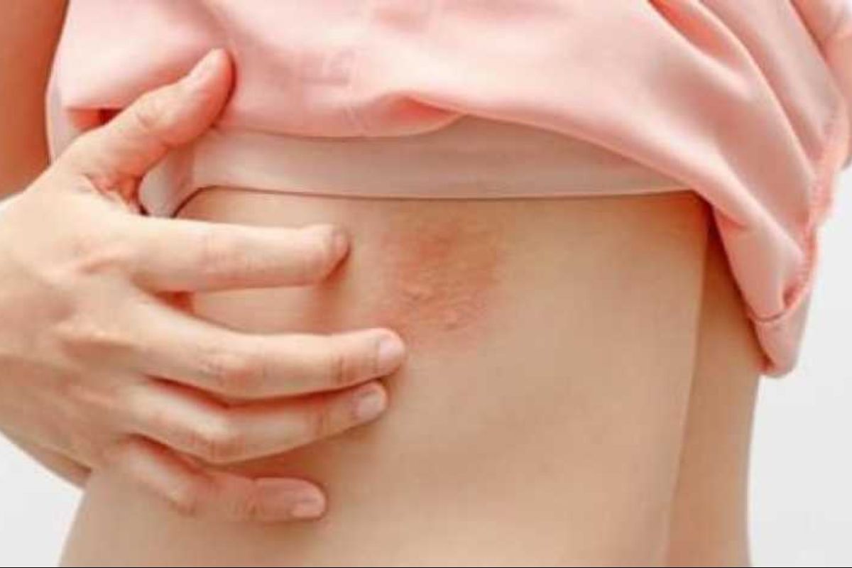 иллюстративное фото