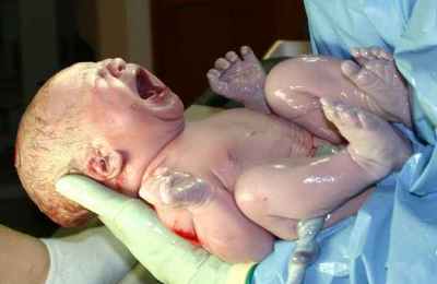 Неонатальная и конъюгационная желтуха у новорожденных: симптомы, признаки, лечение