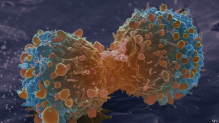 Ученые: большинство видов рака - дело случая