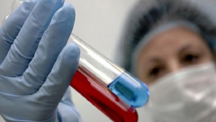 Т. Дуйсенова: в РК лабораторно подтвержден второй летальный случай от осложнений гриппа А