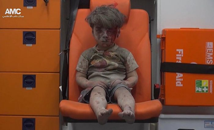 Минобороны РФ раскритиковало СМИ за публикации фото сирийского мальчика Омрана