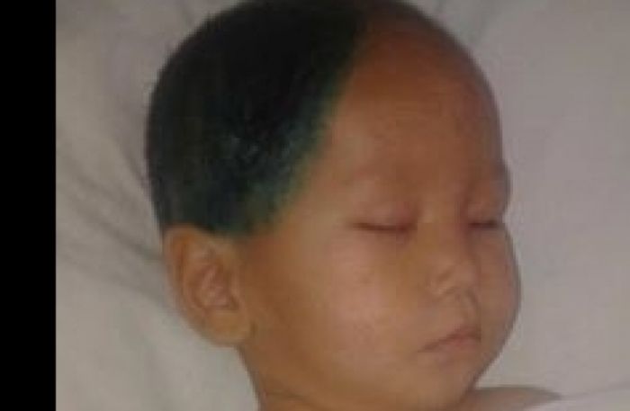 Медики прокомментировали состояние избитого няней мальчика в Алматы