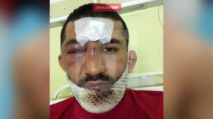 Бойца Расула Мирзаева пытались задушить цепью