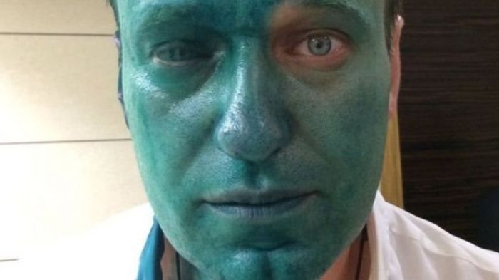 Нападение на Навального связали с движением SERB