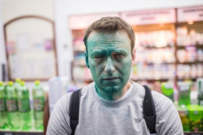Из-за нападения Навальный потерял 80 процентов зрения на правом глазу