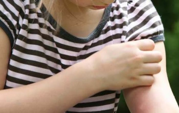 Не комары так блохи