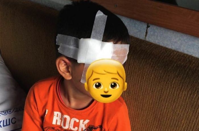 Два ребенка пострадали из-за упавшей в поезде полки 