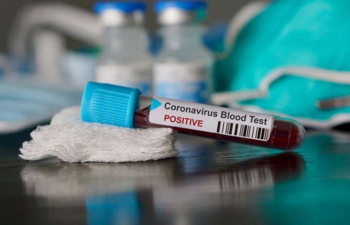 Около 700 тестов на коронавирус имеется в Атырауской области 