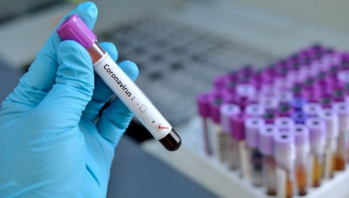 Шестой случай заражения коронавирусом выявлен в Атырауской области 